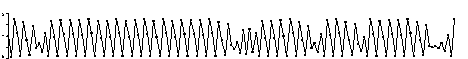 A time series plot