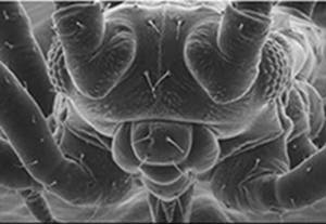 Figure 3: Electron microscope picture of a fly.  The resolving power of an optical lens depends on the wavelength of the light used.  An electron-microscope exploits the wave-like properties of particles to reveal details that would be impossible to see with visible light.