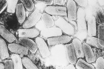 Image of virus